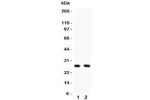 Western blot testing of Olig1 antibody and Lane 1:  U87;  2: HeLa lysate (OLIG1 anticorps  (N-Term))