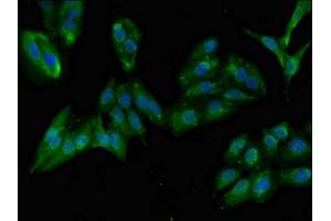 Immunofluorescent analysis of Hela cells using ABIN7144546 at dilution of 1:100 and Alexa Fluor 488-congugated AffiniPure Goat Anti-Rabbit IgG(H+L)