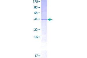 Image no. 1 for Noggin (NOG) (AA 28-232) protein (GST tag) (ABIN1312765)