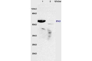 Lane 1: mouse lung lysates Lane 2: mouse brain lysates probed with Anti ROR Gamma/RORC/NR1F3 Polyclonal Antibody, Unconjugated (ABIN750298) at 1:200 in 4 °C. (RORC anticorps)