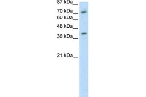 Western Blotting (WB) image for anti-Zinc Finger Protein 282 (ZNF282) antibody (ABIN2461700) (ZNF282 anticorps)