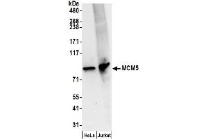 Western Blotting (WB) image for anti-Minichromosome Maintenance Complex Component 5 (MCM5) (AA 1-50) antibody (ABIN7454594)