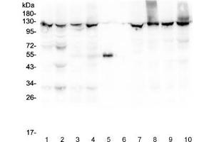 Western blot testing of 1) rat liver, 2) rat lung, 3) mouse liver, 4) mouse lung, 5) rabbit IgG, 6) molecular weight marker, 7) human HepG2, 8) human SMMC-7721, 9) human HeLa and 10) human Jurkat lysate with XPO1 antibody at 0.