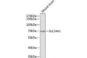Western blot analysis of extracts of Mouse brain using SLC34A1 Polyclonal Antibody at dilution of 1:1000. (Solute Carrier Family 34 (Type II Sodium/phosphate Contransporter), Member 1 (SLC34A1) anticorps)
