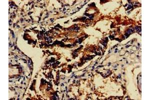 Immunohistochemistry of paraffin-embedded human lung tissue using ABIN7153954 at dilution of 1:100