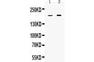 Western blot analysis of Periplakin expression in rat stomach extract ( Lane 1) and HELA whole cell lysates ( Lane 2). (PPL anticorps  (C-Term))