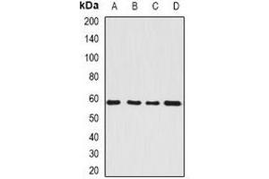 Western blot analysis of SerRS expression in HepG2 (A), Hela (B), mouse kidney (C), rat brain (D) whole cell lysates. (Seryl-tRNA Synthetase (SARS) anticorps)