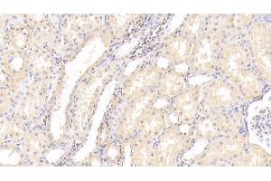 Detection of MAP2K7 in Human Kidney Tissue using Polyclonal Antibody to Mitogen Activated Protein Kinase Kinase 7 (MAP2K7) (MAP2K7 anticorps  (AA 113-388))