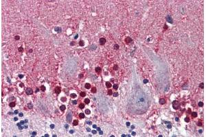 Human Brain, Cerebellum: Formalin-Fixed, Paraffin-Embedded (FFPE)