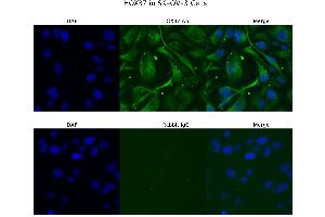 Sample Type : SKOV3  Primary Antibody Dilution: 4 ug/ml  Secondary Antibody : Anti-rabbit Alexa 546  Secondary Antibody Dilution: 2 ug/ml  Gene Name : HOXB7