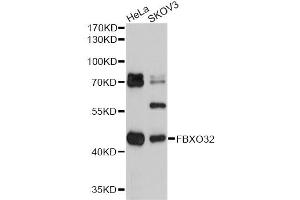 Western blot analysis of extracts of various cell lines, using FBXO32 antibody (ABIN1872667) at 1:2000 dilution. (FBXO32 anticorps)