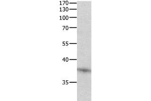 Western Blot analysis of Jurkat cell using DUSP12 Polyclonal Antibody at dilution of 1:500 (DUSP12 anticorps)