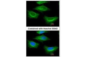 ICC/IF Image Immunofluorescence analysis of paraformaldehyde-fixed HeLa, using beta Tubulin 2, antibody at 1:200 dilution.