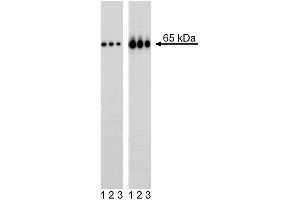 Western blot analysis of NF-kappaB p65 (pS529) in transformed human epithelioid carcinoma. (NFkB anticorps  (pSer529))