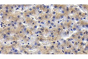 Detection of TNFa in Porcine Liver Tissue using Polyclonal Antibody to Tumor Necrosis Factor Alpha (TNFa)
