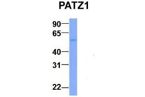 Host:  Rabbit  Target Name:  PATZ1  Sample Type:  Human Adult Placenta  Antibody Dilution:  1. (PATZ1 anticorps  (N-Term))