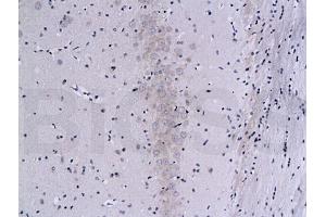 Formalin-fixed and paraffin embedded rat brain labeled with Mouse Anti-Calcineurin A/PP-2B alpha 1 Polyclonal Antibody (ABIN723890), Unconjugated 1:200 followed by conjugation to the secondary antibody and DAB staining (Calcineurin A anticorps  (AA 15-80))