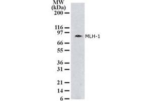 Image no. 1 for anti-MutL Homolog 1 (MLH1) (AA 387-403) antibody (ABIN208109) (MLH1 anticorps  (AA 387-403))