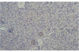 Immunohistochemistry of paraffin-embedded Mouse kidney tissue using TBP Monoclonal Antibody at dilution of 1:200. (TBP anticorps)
