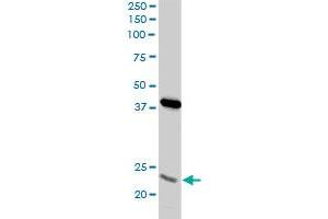 PSMA8 monoclonal antibody (M03A), clone 2E3.