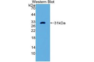 Western blot analysis of the recombinant protein. (PLAP anticorps  (AA 68-313))
