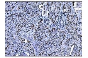 IHC analysis of Ki67 using anti-Ki67 antibody (ABIN7601100). (Ki-67 anticorps  (AA 2860-3256))