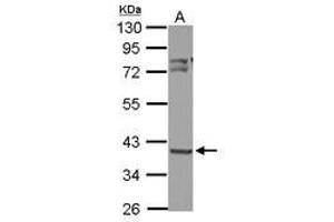 Image no. 3 for anti-3-Oxoacyl-ACP Synthase, Mitochondrial (OXSM) (AA 234-423) antibody (ABIN1501992)