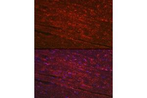 Immunofluorescence analysis of mouse heart using PG Rabbit pAb (ABIN6132481, ABIN6145500, ABIN6145501 and ABIN6223912) at dilution of 1:100 (40x lens).