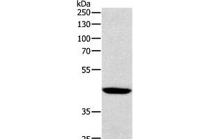 Western Blot analysis of Human lymphoma tissue using SOX-7 Polyclonal Antibody at dilution of 1:1100 (SOX7 anticorps)