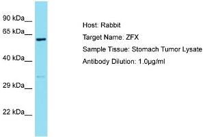 Host: Rabbit Target Name: ZFX Sample Type: Stomach Tumor lysates Antibody Dilution: 1. (ZFX anticorps  (C-Term))