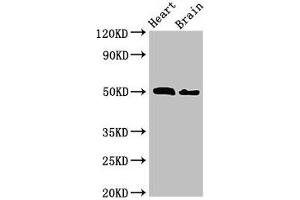 Western Blot Positive WB detected in: Mouse heart tissue, Mouse brain tissue All lanes: VPS4B antibody at 2. (VPS4B anticorps  (AA 1-117))