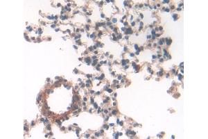 Used in DAB staining on fromalin fixed paraffin- embedded lung tissue (GM-CSF anticorps  (AA 19-141))