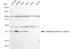 Western blotting analysis using Epithelial cell adhesion molecule antibody (ABIN7798481).