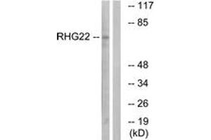 Western blot analysis of extracts from K562 cells, using RHG22 Antibody. (ARHGAP22 anticorps  (AA 565-614))