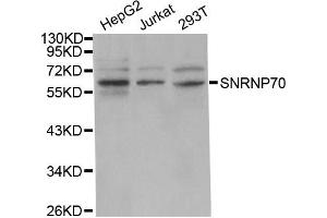 Western Blotting (WB) image for anti-Small Nuclear Ribonucleoprotein 70kDa (U1) (SNRNP70) antibody (ABIN1877092) (SNRNP70 anticorps)