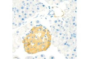 Immunohistochemistry of paraffin embedded rat pancreas+LPS using MADCAM1 (ABIN7074695) at dilution of 1:1800 (400x lens) (MADCAM1 anticorps)
