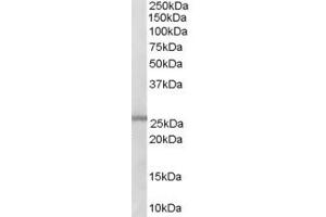 Western Blotting (WB) image for anti-Glutathione S-Transferase mu 1/2 (GSTM1/2) (C-Term) antibody (ABIN393122) (GSTM1/2 anticorps  (C-Term))