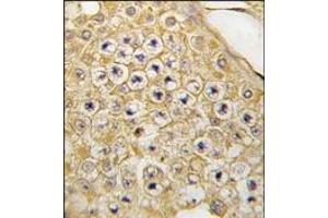Formalin-fixed and paraffin-embedded human testis tissue reacted with PBK Antibody (C-term), which was peroxidase-conjugated to the secondary antibody, followed by DAB staining.