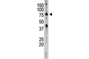 IKKE antibody used in western blot to detect IKKE in 293 cell lysate