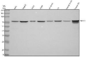 Western blot analysis of NEK11 using anti-NEK11 antibody (ABIN7602376).