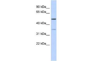 WB Suggested Anti-CETP Antibody Titration: 0. (CETP anticorps  (Middle Region))