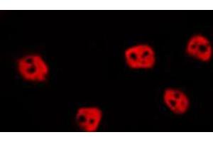 ABIN6274015 staining HepG2 by IF/ICC. (EPAS1 anticorps  (Internal Region))