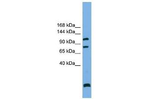 PPP6R1 antibody used at 1 ug/ml to detect target protein. (SAPS1 anticorps  (N-Term))
