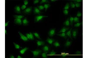 Immunofluorescence of monoclonal antibody to MGC13096 on HeLa cell. (PDCD2L anticorps  (AA 80-179))