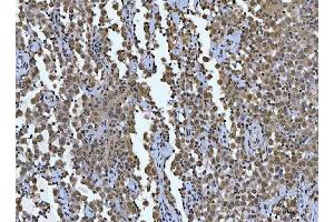 IHC analysis of AREB6/ZEB1 using anti-AREB6/ZEB1 antibody (ABIN7602990).