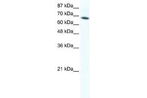 WB Suggested Anti-DDX1 Antibody Titration:  1. (DDX1 anticorps  (C-Term))