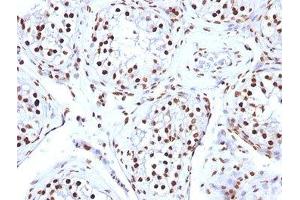 FFPE human testicular carcinoma tested with Histone antibody (AE-4) (Histone anticorps)