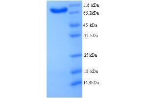 SDS-PAGE (SDS) image for B-Cell Scaffold Protein with Ankyrin Repeats 1 (BANK1) (AA 1-785), (full length) protein (His tag) (ABIN5714428)