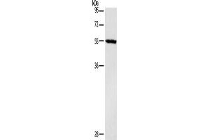 Gel: 10 % SDS-PAGE, Lysate: 40 μg, Lane: Mouse heart tissue, Primary antibody: ABIN7190465(DGAT1 Antibody) at dilution 1/1400, Secondary antibody: Goat anti rabbit IgG at 1/8000 dilution, Exposure time: 40 seconds (DGAT1 anticorps)