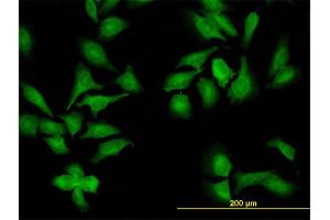 Immunofluorescence of monoclonal antibody to NEK9 on HeLa cell.
